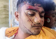 কুলাউড়ায় সড়ক দুর্ঘটনায় মোটর সাইকেল চালক নিহত
