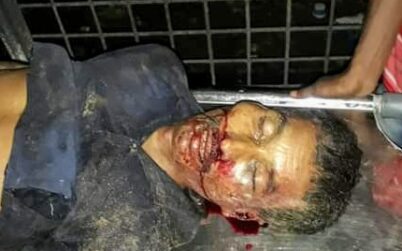 কুলাউড়ায় মালবাহী গাড়ি উল্টে নিহত ১