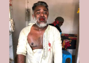 জুড়ীতে উপজেলা চেয়ারম্যান প্রার্থীর উপর সন্ত্রাসী হামলা
